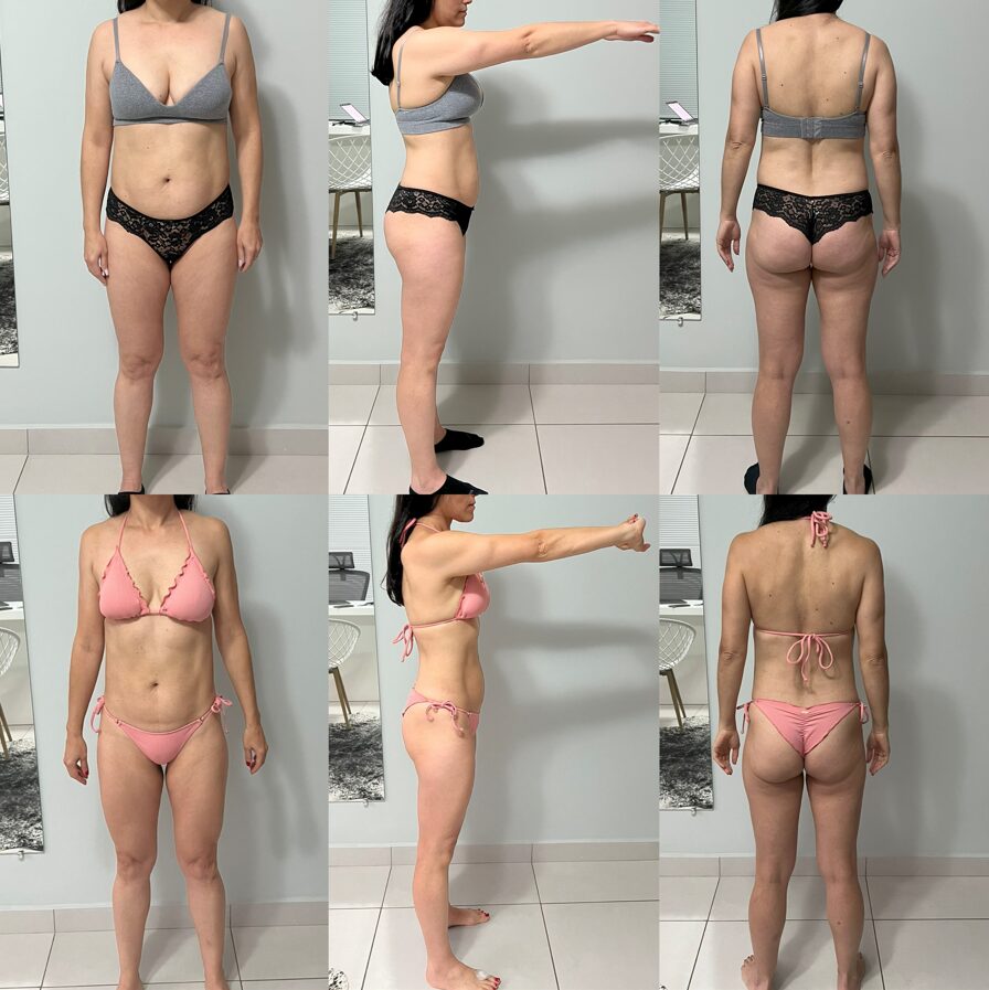 Resultado de paciente — antes e depois